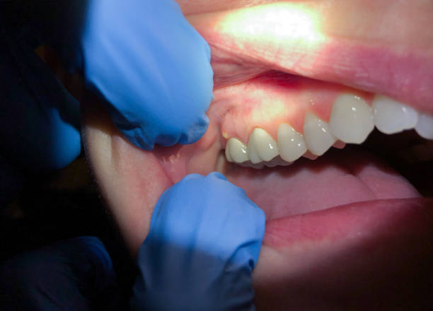 Best Emergency Dental Surgery in Hoxie, KS